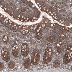 GTPBP9 Antibody in Immunohistochemistry (Paraffin) (IHC (P))