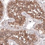 GTPBP9 Antibody in Immunohistochemistry (Paraffin) (IHC (P))
