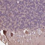 PCDHA12 Antibody in Immunohistochemistry (Paraffin) (IHC (P))