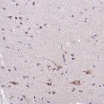 CGI58 Antibody in Immunohistochemistry (Paraffin) (IHC (P))