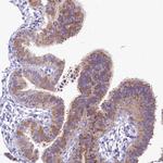 CGI58 Antibody in Immunohistochemistry (Paraffin) (IHC (P))
