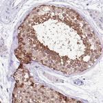 CGI58 Antibody in Immunohistochemistry (Paraffin) (IHC (P))