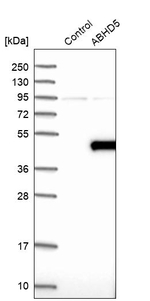 CGI58 Antibody in Western Blot (WB)