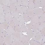 CGI58 Antibody in Immunohistochemistry (Paraffin) (IHC (P))