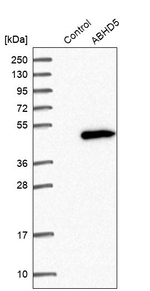 CGI58 Antibody in Western Blot (WB)