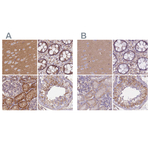 alpha Adducin Antibody in Immunohistochemistry (Paraffin) (IHC (P))