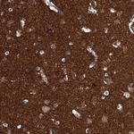 beta Synuclein Polyclonal Antibody