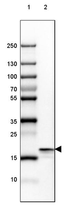 beta Synuclein Antibody in Western Blot (WB)