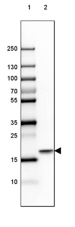 beta Synuclein Antibody in Western Blot (WB)