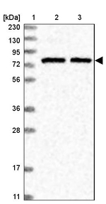 SLU7 Antibody in Western Blot (WB)