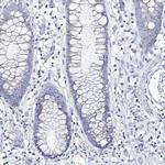 CSN3 (CASK) Antibody in Immunohistochemistry (Paraffin) (IHC (P))