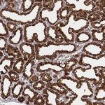 CSN3 (CASK) Antibody in Immunohistochemistry (Paraffin) (IHC (P))