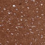 Ankyrin B Antibody in Immunohistochemistry (Paraffin) (IHC (P))