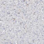 PD-1 Antibody in Immunohistochemistry (Paraffin) (IHC (P))