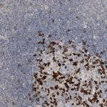 PD-1 Antibody in Immunohistochemistry (Paraffin) (IHC (P))