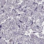 PD-1 Antibody in Immunohistochemistry (Paraffin) (IHC (P))