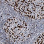 PD-1 Antibody in Immunohistochemistry (Paraffin) (IHC (P))