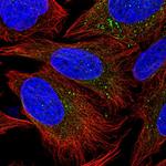 PIK3R4 Polyclonal Antibody