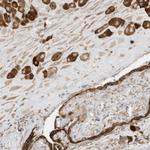 BRK Polyclonal Antibody