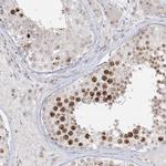 BRK Polyclonal Antibody