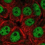 ELK1 Polyclonal Antibody