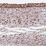 ELK1 Antibody in Immunohistochemistry (Paraffin) (IHC (P))