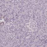 ELK1 Antibody in Immunohistochemistry (Paraffin) (IHC (P))