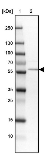 PPAT Antibody in Western Blot (WB)