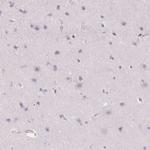 Golgi protein 58k Antibody in Immunohistochemistry (Paraffin) (IHC (P))
