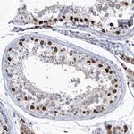 HKR1 Antibody in Immunohistochemistry (Paraffin) (IHC (P))