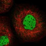 SFMBT1 Polyclonal Antibody