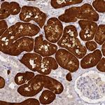 Aminoacylase Polyclonal Antibody