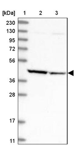 Aminoacylase Antibody in Western Blot (WB)
