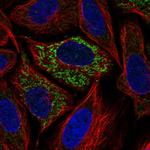 Glutaminase Polyclonal Antibody