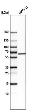 Glutaminase Antibody in Western Blot (WB)