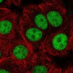 USF1 Polyclonal Antibody