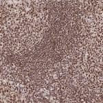 USF1 Antibody in Immunohistochemistry (Paraffin) (IHC (P))