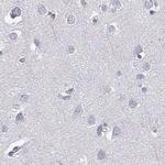 C6orf58 Antibody in Immunohistochemistry (Paraffin) (IHC (P))