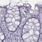 C6orf58 Antibody in Immunohistochemistry (Paraffin) (IHC (P))