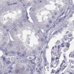 C6orf58 Antibody in Immunohistochemistry (Paraffin) (IHC (P))