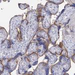 IGSF3 Polyclonal Antibody