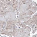 IGSF3 Antibody in Immunohistochemistry (Paraffin) (IHC (P))