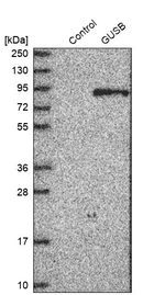 GUSB Antibody in Western Blot (WB)