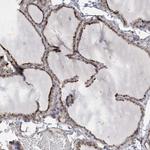 APC1 Polyclonal Antibody