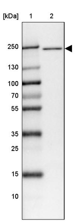 APC1 Antibody in Western Blot (WB)