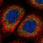 ALS2CR1 Polyclonal Antibody