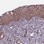 CD104 Antibody in Immunohistochemistry (Paraffin) (IHC (P))
