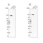 CD104 Antibody in Western Blot (WB)