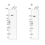 CD104 Antibody in Western Blot (WB)
