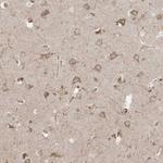 TRAF3IP2 Antibody in Immunohistochemistry (Paraffin) (IHC (P))